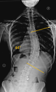 -Tratamento Case1Pre